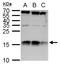 Nuclear nucleic acid-binding protein C1D antibody, GTX129439, GeneTex, Western Blot image 