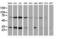 SSX Family Member 1 antibody, LS-C172870, Lifespan Biosciences, Western Blot image 