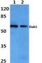 Disabled homolog 1 antibody, PA5-75444, Invitrogen Antibodies, Western Blot image 