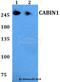 Calcineurin-binding protein cabin-1 antibody, A05463, Boster Biological Technology, Western Blot image 