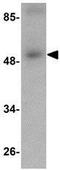Scavenger Receptor Class A Member 5 antibody, GTX85270, GeneTex, Western Blot image 