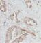 Actin Related Protein 2/3 Complex Subunit 4 antibody, FNab00603, FineTest, Immunohistochemistry paraffin image 