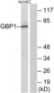Guanylate Binding Protein 1 antibody, abx014002, Abbexa, Western Blot image 