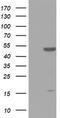 Zinc Finger Protein 385B antibody, TA802747BM, Origene, Western Blot image 
