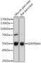 Serpin Family A Member 4 antibody, 22-862, ProSci, Western Blot image 