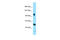 Synergin Gamma antibody, ARP66292_P050, Aviva Systems Biology, Western Blot image 