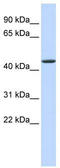 Jumonji Domain Containing 4 antibody, TA333695, Origene, Western Blot image 