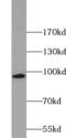 Kinesin Family Member 6 antibody, FNab04569, FineTest, Western Blot image 