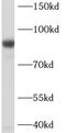 Voltage-dependent L-type calcium channel subunit beta-2 antibody, FNab01175, FineTest, Western Blot image 