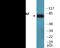 Raf-1 Proto-Oncogene, Serine/Threonine Kinase antibody, EKC2244, Boster Biological Technology, Western Blot image 
