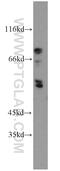 Ectonucleoside Triphosphate Diphosphohydrolase 8 antibody, 21010-1-AP, Proteintech Group, Western Blot image 