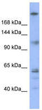 Kinetochore-associated protein 1 antibody, TA334232, Origene, Western Blot image 