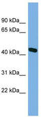 Calcium/Calmodulin Dependent Protein Kinase ID antibody, TA344784, Origene, Western Blot image 