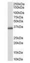 Prostaglandin F synthase antibody, orb18943, Biorbyt, Western Blot image 