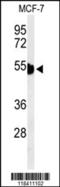 Keratin 1 antibody, 64-066, ProSci, Western Blot image 