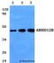 Abhydrolase Domain Containing 12B antibody, LS-C411968, Lifespan Biosciences, Western Blot image 