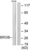 BRI3 Binding Protein antibody, A30536, Boster Biological Technology, Western Blot image 