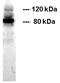 Cadherin 1 antibody, BM6016P, Origene, Western Blot image 