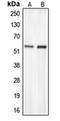 Carbohydrate sulfotransferase 2 antibody, orb214898, Biorbyt, Western Blot image 