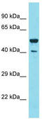 Segment polarity protein dishevelled homolog DVL-2 antibody, TA329902, Origene, Western Blot image 
