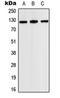 Janus Kinase 2 antibody, orb214137, Biorbyt, Western Blot image 
