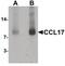 C-C Motif Chemokine Ligand 17 antibody, PA5-34515, Invitrogen Antibodies, Western Blot image 