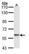 Interferon Induced Protein With Tetratricopeptide Repeats 3 antibody, TA307923, Origene, Western Blot image 