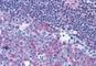CD40 Molecule antibody, NBP1-39881, Novus Biologicals, Immunohistochemistry frozen image 