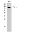 Protein Kinase C Epsilon antibody, STJ95128, St John