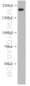 Myosin Heavy Chain 14 antibody, 20716-1-AP, Proteintech Group, Western Blot image 