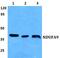 NADH:Ubiquinone Oxidoreductase Subunit A9 antibody, PA5-36993, Invitrogen Antibodies, Western Blot image 