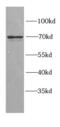 Golgi Associated, Gamma Adaptin Ear Containing, ARF Binding Protein 2 antibody, FNab03442, FineTest, Western Blot image 