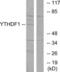YTH N6-Methyladenosine RNA Binding Protein 1 antibody, LS-B10000, Lifespan Biosciences, Western Blot image 