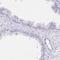 Uncharacterized protein C1orf222 antibody, HPA029274, Atlas Antibodies, Immunohistochemistry frozen image 