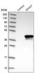 ZW10 Interacting Kinetochore Protein antibody, HPA005757, Atlas Antibodies, Western Blot image 