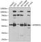 Mitochondrial Transcription Termination Factor 3 antibody, GTX65988, GeneTex, Western Blot image 
