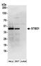Starch-binding domain-containing protein 1 antibody, A304-481A, Bethyl Labs, Western Blot image 
