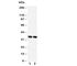 Podoplanin antibody, R30760, NSJ Bioreagents, Western Blot image 