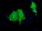 Von Willebrand Factor A Domain Containing 5A antibody, LS-C115524, Lifespan Biosciences, Immunofluorescence image 