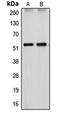 Cytochrome P450 Family 26 Subfamily A Member 1 antibody, orb213834, Biorbyt, Western Blot image 