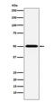 Chaperonin Containing TCP1 Subunit 2 antibody, M05524-2, Boster Biological Technology, Western Blot image 