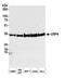 Ubiquitin carboxyl-terminal hydrolase 4 antibody, A300-830A, Bethyl Labs, Western Blot image 