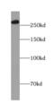 Insulin Like Growth Factor 2 Receptor antibody, FNab04174, FineTest, Western Blot image 