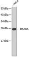 Ras-related protein Rab-8A antibody, 18-822, ProSci, Western Blot image 