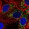 Pyruvate carboxylase, mitochondrial antibody, HPA058765, Atlas Antibodies, Immunofluorescence image 
