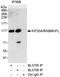 Kinesin-like protein KIF20A antibody, A300-878A, Bethyl Labs, Immunoprecipitation image 