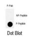 Protein Kinase, Membrane Associated Tyrosine/Threonine 1 antibody, abx031880, Abbexa, Immunohistochemistry paraffin image 