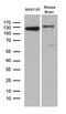 Drebrin 1 antibody, LS-C796263, Lifespan Biosciences, Western Blot image 
