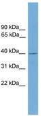 F-Box Protein 31 antibody, TA335459, Origene, Western Blot image 