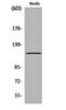 Suppression of tumorigenicity 18 protein antibody, orb162847, Biorbyt, Western Blot image 
